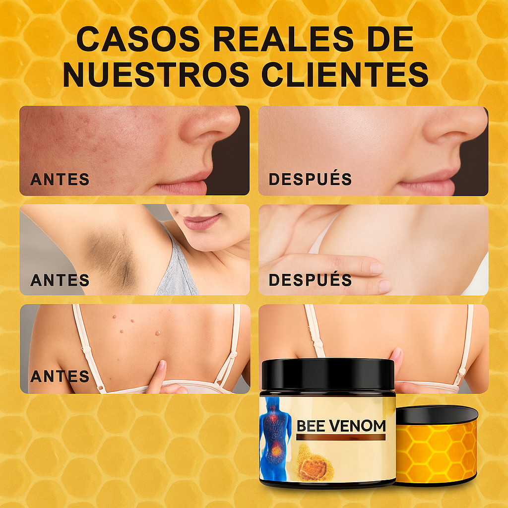 Crema de Abejas – Alivio natural al instante y cuidado de la piel 🐝