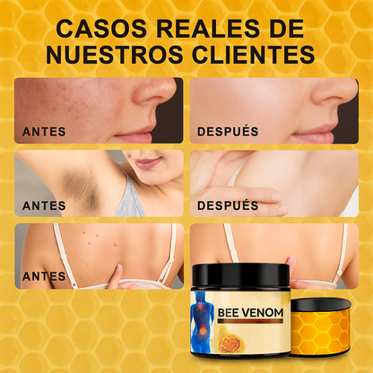 Crema de Abejas – Alivio natural al instante y cuidado de la piel 🐝